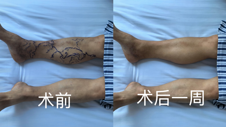 08db2b799dae4232bf1450f02d36c242.png
